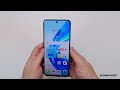 HONOR X7b ASMR Unboxing & First Look