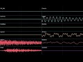 Metal 3 (Variation 3) (Unused) - Pikmin 2 (High Quality + Oscilloscope)