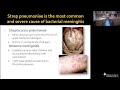 Virtual Resident Education Lecture Series: Neuroinfectious Diseases - American Academy of Neurology