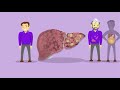 Cirrhosis - What is cirrhosis?