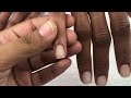 Perfect One Ball Acrylic Shorties|Tips for Nail Techs|Acrylic Overlay