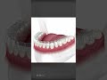 How Does Invisalign Aligners Work To Straighten Teeth
