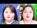 Talk với Dr.Dung (Mùa 3) | Tập 59: BÁC SĨ TÚ DUNG giải đáp toàn bộ về CẤY MỠ TỰ THÂN