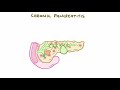 Chronic pancreatitis - causes, symptoms, diagnosis, treatment, pathology