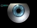 TransPRK - The Bladeless, Flapless LASIK