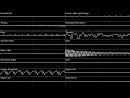 Titan Dweevil - Pikmin 2 (High Quality + Oscilloscope)