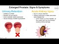 enlarged prostate (benign prostatic hyperplasia)