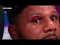 David Benavidez vs Anthony Dirrell HIGHLIGHTS | BOXING FIGHT HD