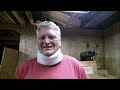 Surgical implant surgery recovery day 8