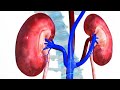 Home remedy to cure/remove kidney stones_Tamil