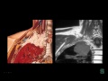 Michigan State University Department of Radiology Lecture: The Brachial Plexus